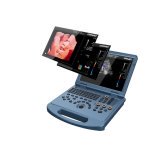 Ультразвукова 4D діагностична система Експертного класу, з конвексним датчиком у комплекті DW-L50 4D D-live