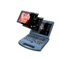 Ультразвукова 4D діагностична система Експертного класу, з конвексним датчиком у комплекті DW-L50 4D D-live