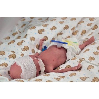 Симулятор недоношенного ребёнка NENASim Preemie Xcel