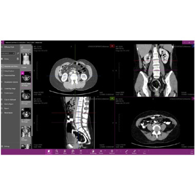 Інтерактивний анатомічний стіл MEDICAL-X