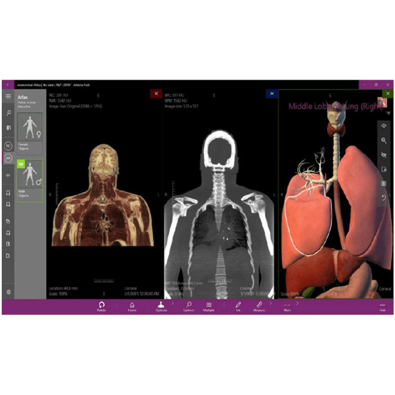 Интерактивный анатомический стол MEDICAL-X