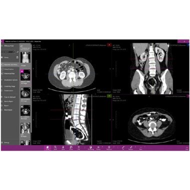 Интерактивный анатомический стол MEDICAL-X