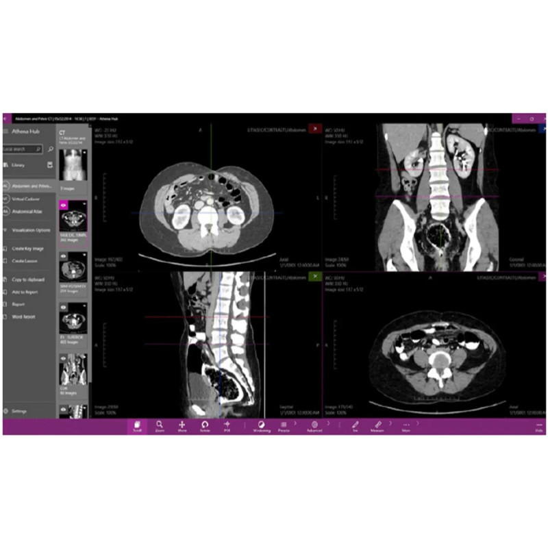 Интерактивный анатомический стол MEDICAL-X