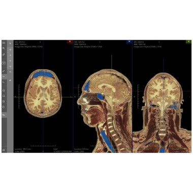 Интерактивный анатомический стол MEDICAL-X